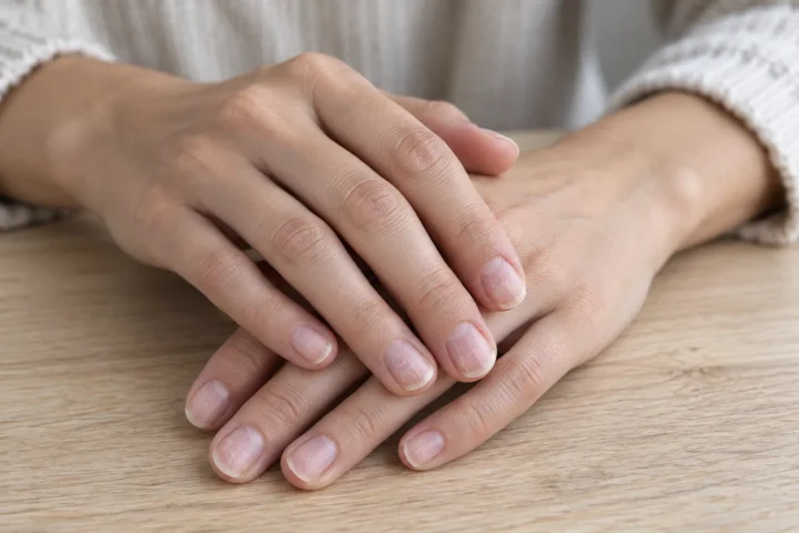 Paznokcie po zdjęciu hybrydy - naturalna płytka bez lakieru